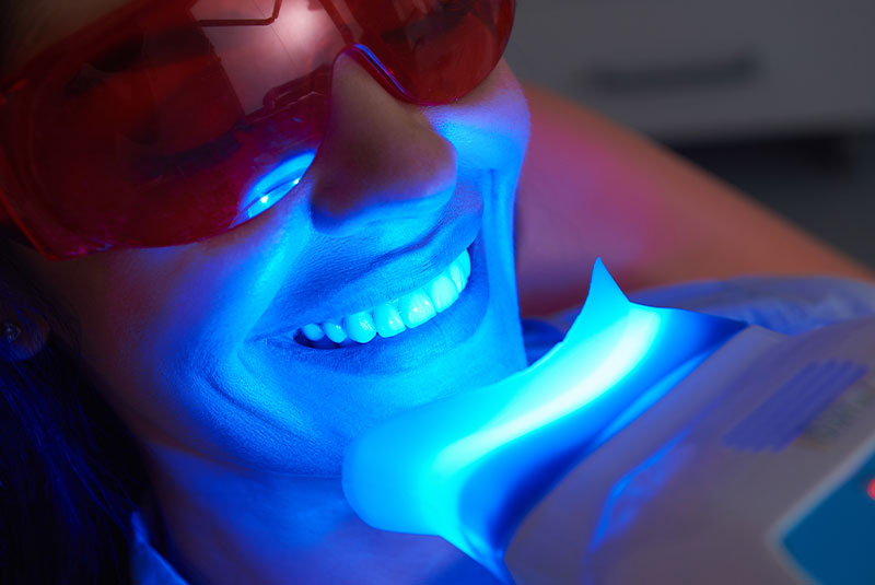 Woman having her teeth whitening