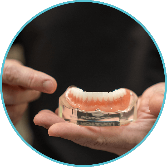 Full Arch dental implants